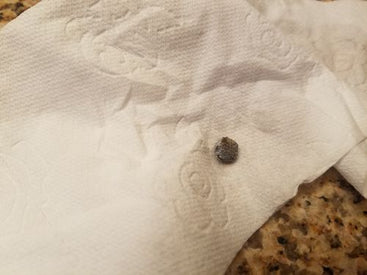 rashied takes a photo of the kidney stone he passed and shows us as proof