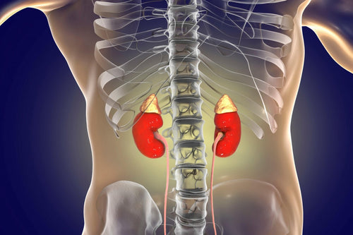 kidney stone health information